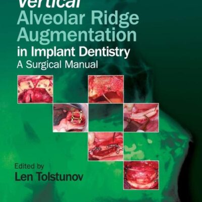 Vertical Alveolar Ridge Augmentation In Implant Dentistry A Surgical Manual (Hb 2016)