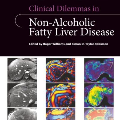 Clinical Dilemmas In Non Alcoholic Fatty Liver Disease (Pb 2016)