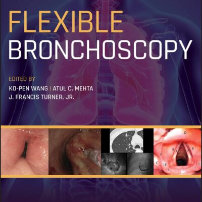 Flexible Bronchoscopy
