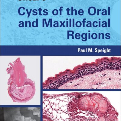 SHEAR'S CYSTS OF THE ORAL AND MAXILLOFACIAL REGIONS 5TH EDITION
