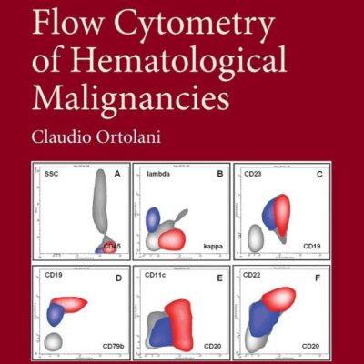 Flow Cytometry of Hematological Malignancies