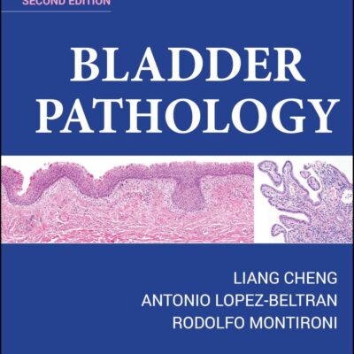 Bladder Pathology