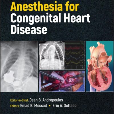 Anesthesia for Congenital Heart Disease 4e