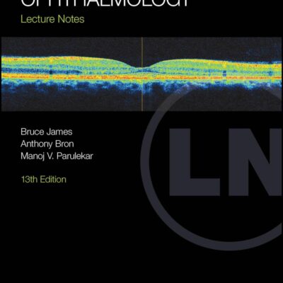 Ophthalmology: Lecture Notes