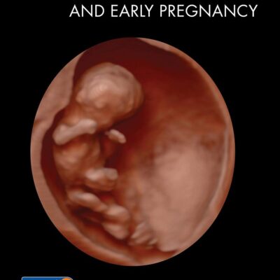 ULTRASOUND IN ASSISTED REPRODUCTION AND EARLY PREGNANCY WITH ACCESS CODE (PB 2021)
