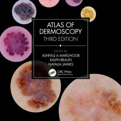 ATLAS OF DERMOSCOPY 3ED (HB 2023): Third Edition