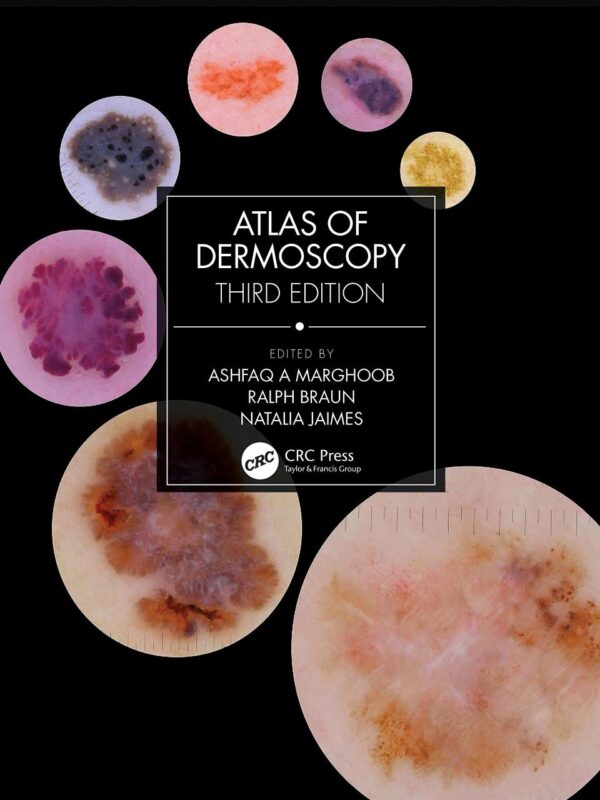 ATLAS OF DERMOSCOPY 3ED (HB 2023): Third Edition
