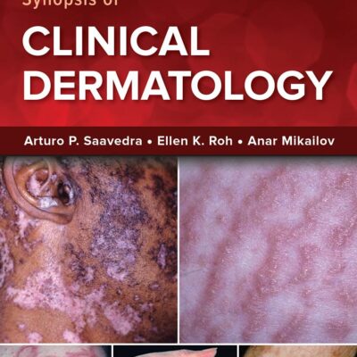 FITZPATRICK'S COLOR ATLAS & SYNOPSIS OF CLINICAL DERMATOLOGY (IE)