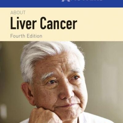 100 Questions & Answers About Liver Cancer