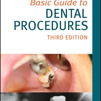 Basic Guide To Dental Procedures 3Ed (Pb 2024) (Basic Guide Dentistry)