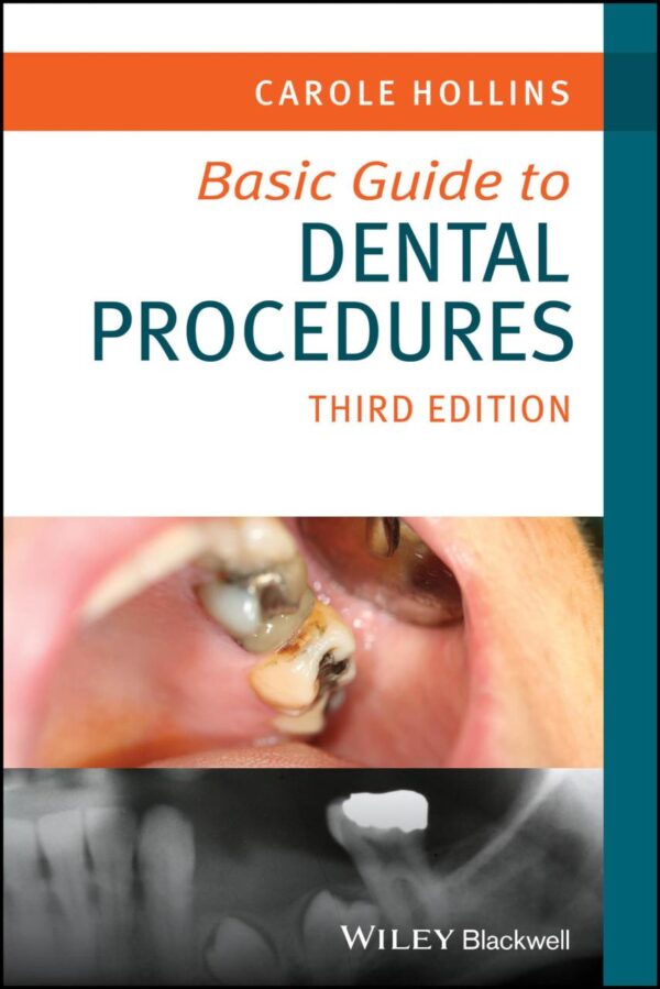 Basic Guide To Dental Procedures 3Ed (Pb 2024) (Basic Guide Dentistry)