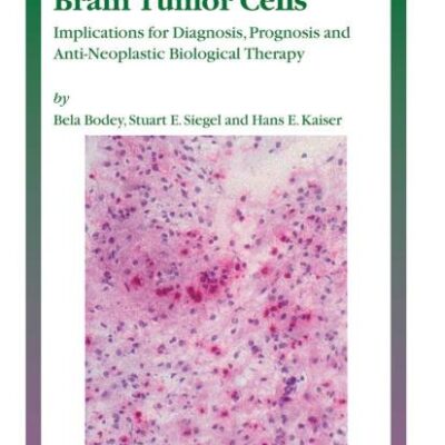 MOLECULAR MARKERS OF BRAIN TUMOR CELLS (HB): Implications for Diagnosis, Prognosis and Anti-Neoplastic Biological Therapy