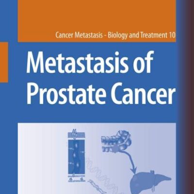METASTASIS OF PROSTATE CANCER (HB): 10 (Cancer Metastasis - Biology and Treatment)