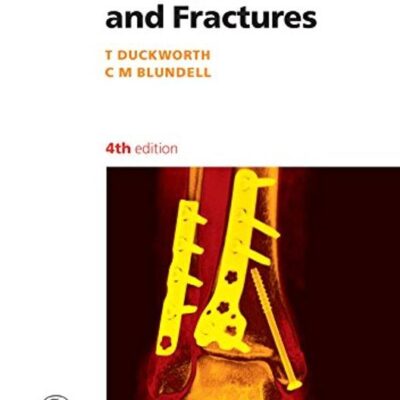 Orthopaedics And Fractures: 12 (Lecture Notes)