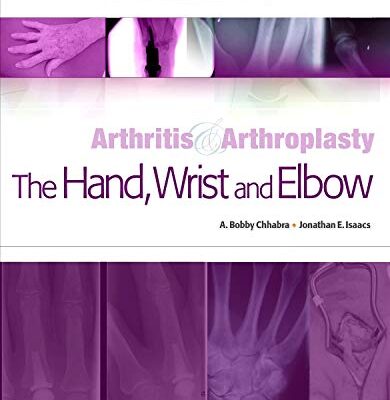ARTHRITIS AND ARTHROPLASTY: THE HAND, WRIST AND ELBOW: EXPERT CONSULT - ONLINE, PRINT AND DVD