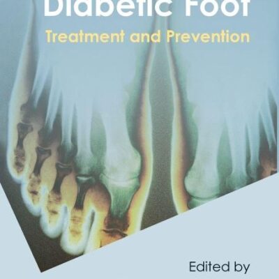 High Risk Diabetic Foot Treatment And Prevention (Hb 2010) Spl Price