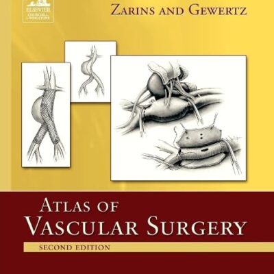 ATLAS OF VASCULAR SURGERY 2ED (PB 2009): Atlas of Vascular Surgery - Paperback Edition