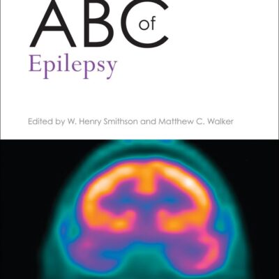 Abc Of Epilepsy: 183 (Abc Series)