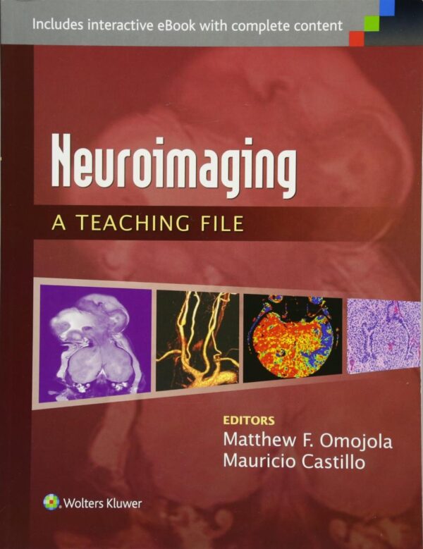 Neuroimaging A Teaching File (Pb 2015)