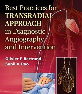 Best Practices For Transradial Approach In Diagnostic Angiography and Intervention