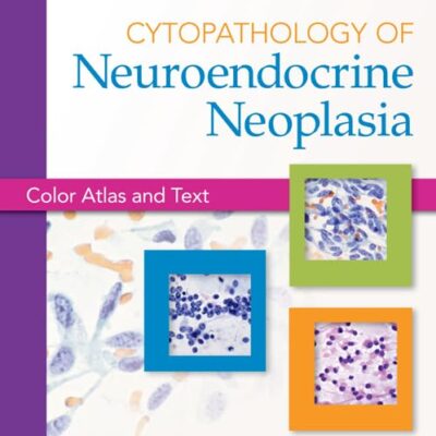 CYTOPATHOLOGY OF NEUROENDOCRINE NEOPLASIA (HB 2013)