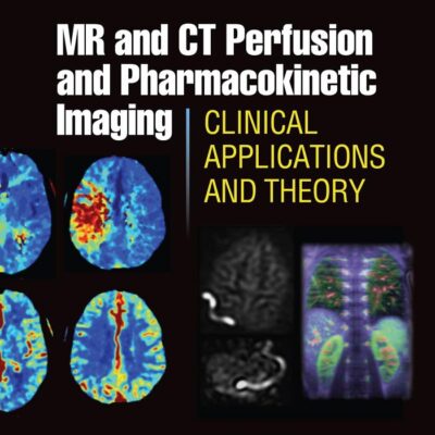 MR AND CT PERFUSION AND PHARMACOKINETIC IMAGING CLINICAL APPLICATIONS AND THEORY (HB 2016)