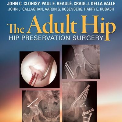 THE ADULT HIP HIP PRESERVATION SURGERY (HB 2015)