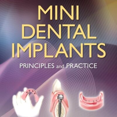 Mini Dental Implants: Principles and Practice