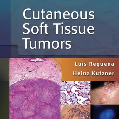 CUTANEOUS SOFT TISSUE TUMORS (HB 2015)