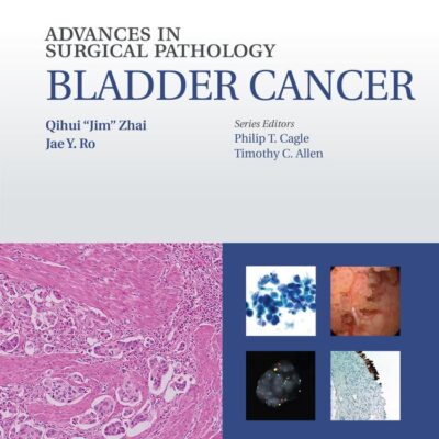 Advances in Surgical Pathology Bladder Cancer (Hb 2016)