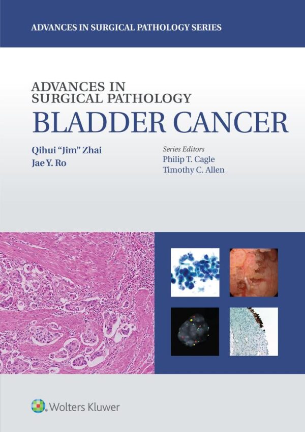 Advances in Surgical Pathology Bladder Cancer (Hb 2016)
