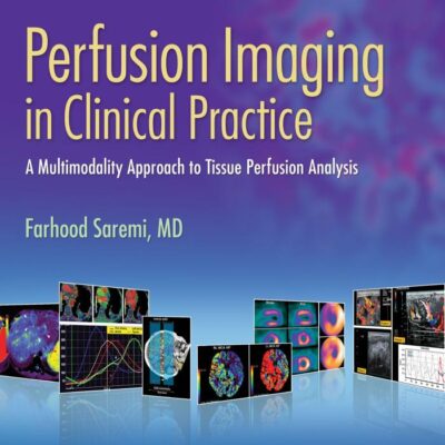 PERFUSION IMAGING IN CLINICAL PRACTICE A MULTIMODALITY APPROACH TO TISSUE PERFUSION ANALYSIS (HB 2015)