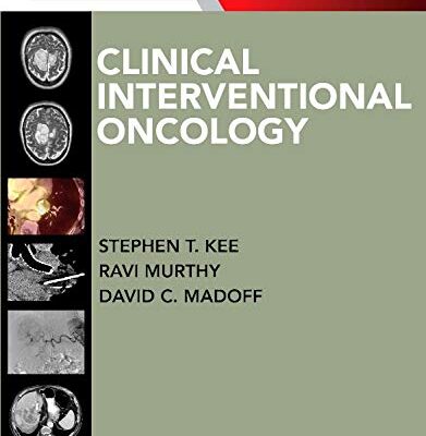 CLINICAL INTERVENTIONAL ONCOLOGY (HB 2014): Expert Consult - Online and Print