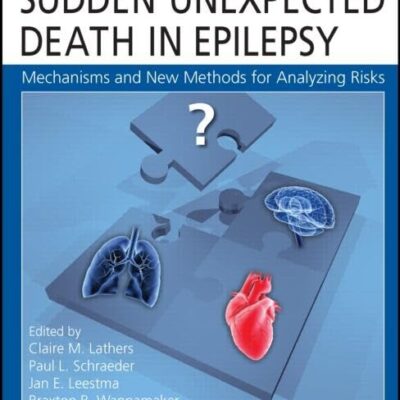 SUDDEN UNEXPECTED DEATH IN EPILEPSY (HB 2015): Mechanisms and New Methods for Analyzing Risks