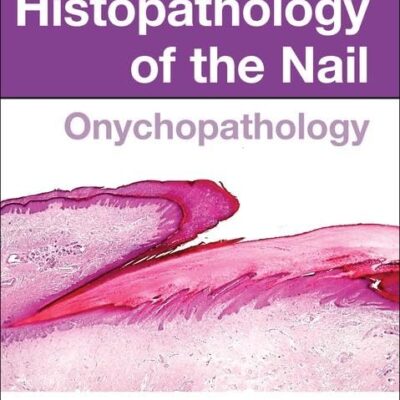HISTOPATHOLOGY OF THE NAIL ONYCHOPATHOLOGY (HB 2017)