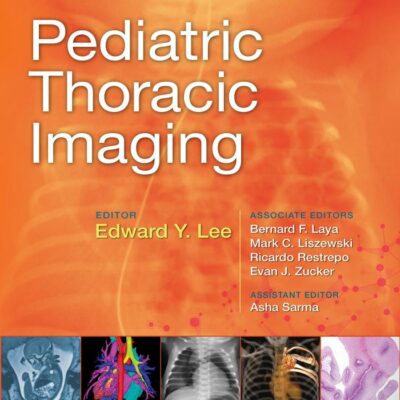 PEDIATRIC THORACIC IMAGING (HB 2019)