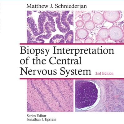 Biopsy Interpretation of the Central Nervous System (Biopsy Interpretation Series)