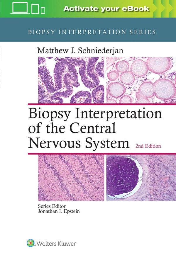 Biopsy Interpretation of the Central Nervous System (Biopsy Interpretation Series)