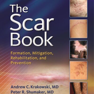 THE SCAR BOOK FORMATION MITIGATION REHABILITATION AND PREVENTION (HB 2017)