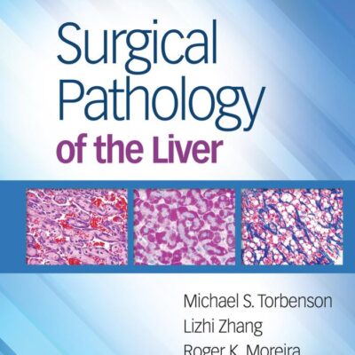 Surgical Pathology Of The Liver (Hb 2018)