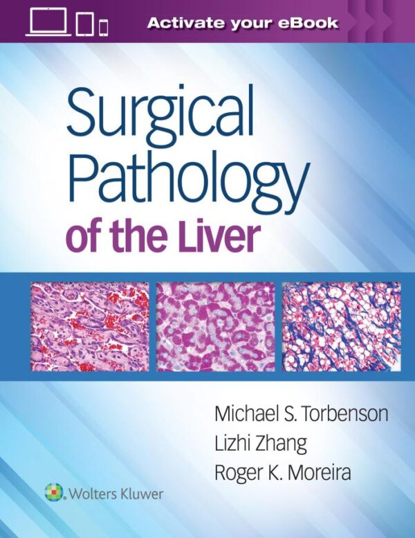 Surgical Pathology Of The Liver (Hb 2018)