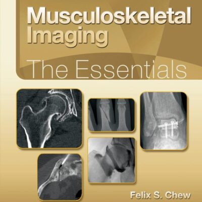 Musculoskeletal Imaging The Essentials (Essentials Series)