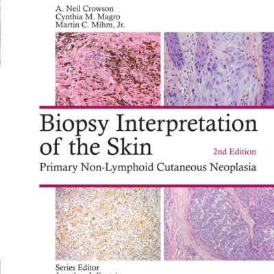 BIOPSY INTERPRETATION OF THE SKIN PRIMARY NON LYMPHOID CUTANEOUS NEOPLASIA 2ED (HB 2018)