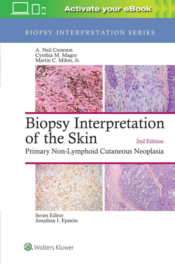 BIOPSY INTERPRETATION OF THE SKIN PRIMARY NON LYMPHOID CUTANEOUS NEOPLASIA 2ED (HB 2018)