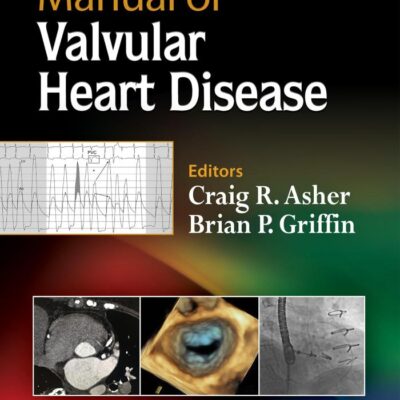 Manual of Valvular Heart Disease
