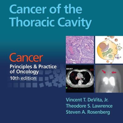 Cancer Of The Thoracic Cavity Cancer: Principles And Practice Of Oncology 10Ed (Pb 2016)