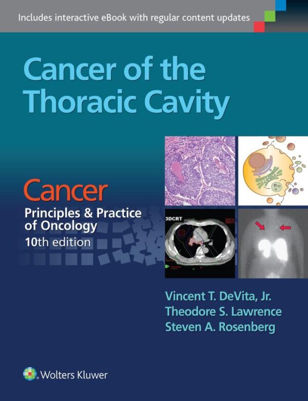 Cancer Of The Thoracic Cavity Cancer: Principles And Practice Of Oncology 10Ed (Pb 2016)