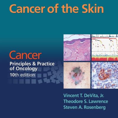 Cancer Of The Skin Cancer Principles And Practice Of Oncology 10Ed (Pb 2016)