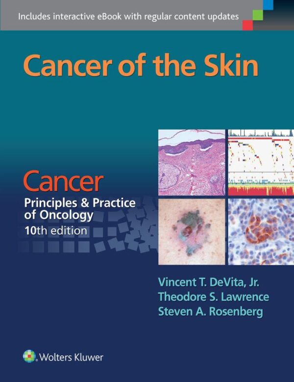 Cancer Of The Skin Cancer Principles And Practice Of Oncology 10Ed (Pb 2016)