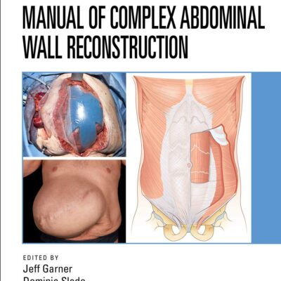 Manual Of Complex Abdominal Wall Reconstruction (Pb 2021)